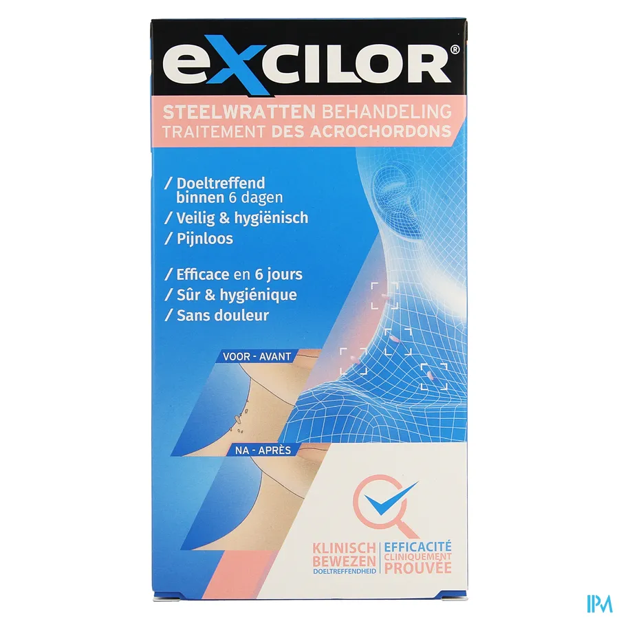 packshot van Excilor voor Veilige, Hygiënische en Pijnloze Behandeling van Steelwratten met 1 Applicator en 3 Steelwrat Pleisterklemmen